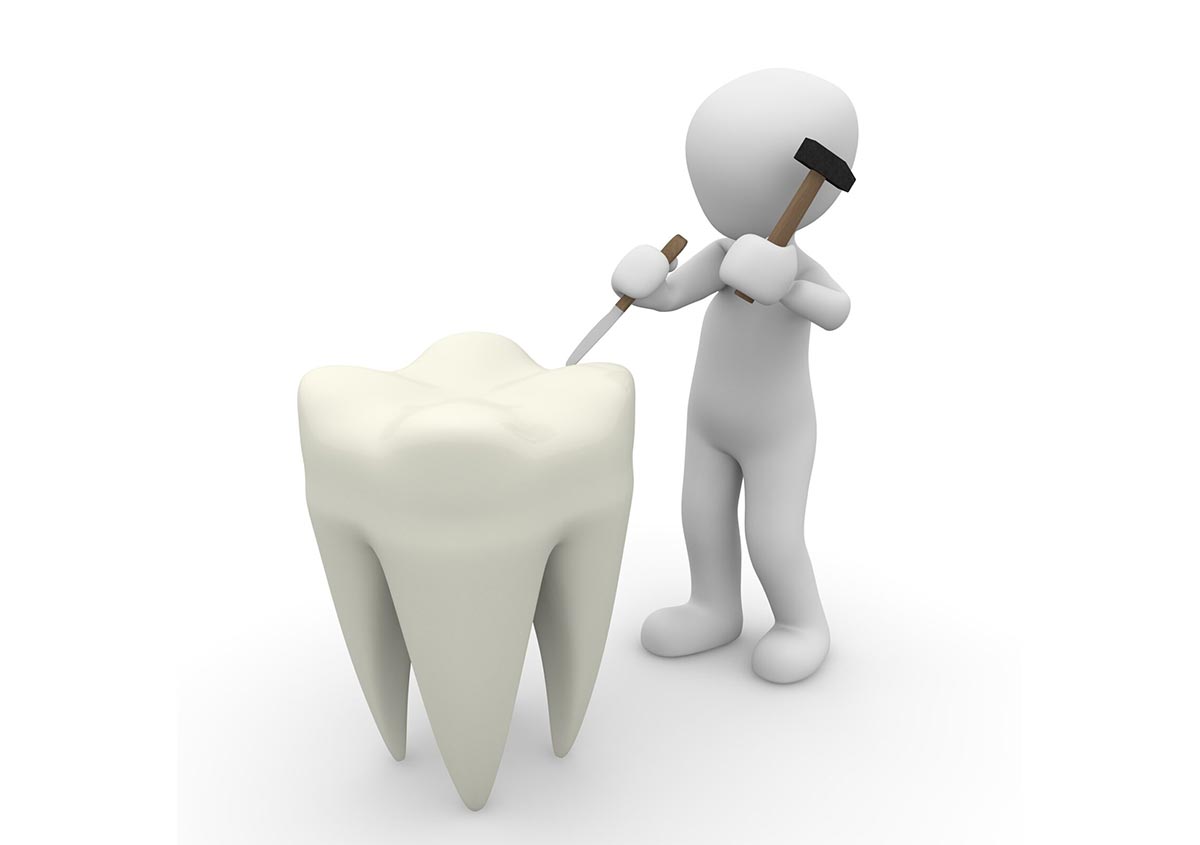 3D model - A man damaging a tooth
