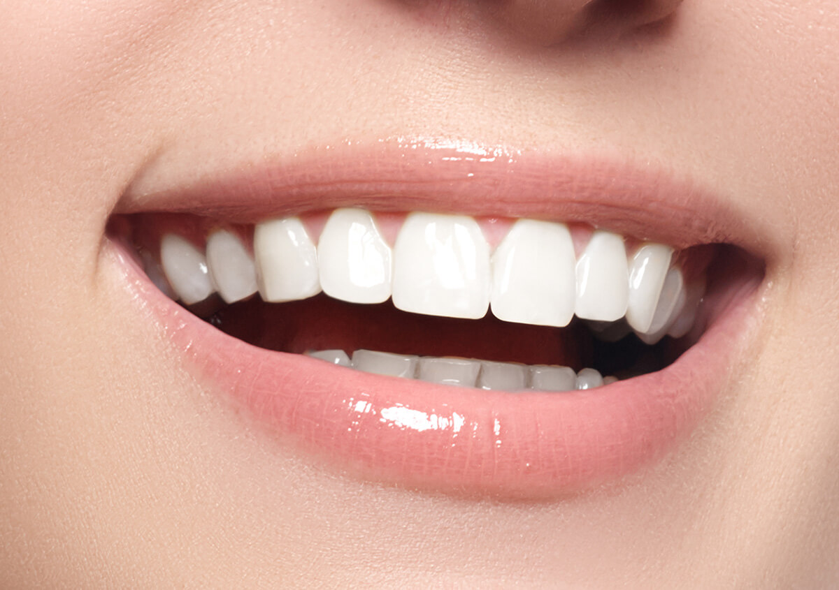 Affordable Cosmetic Dentistry in Chino Hills CA Area